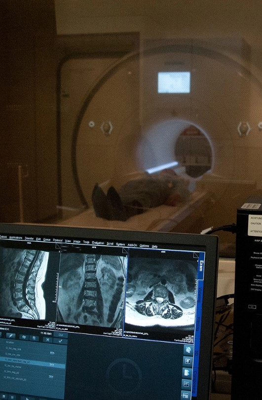 МРТ грудного отдела позвоночника