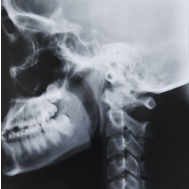 Рентген пазух носа