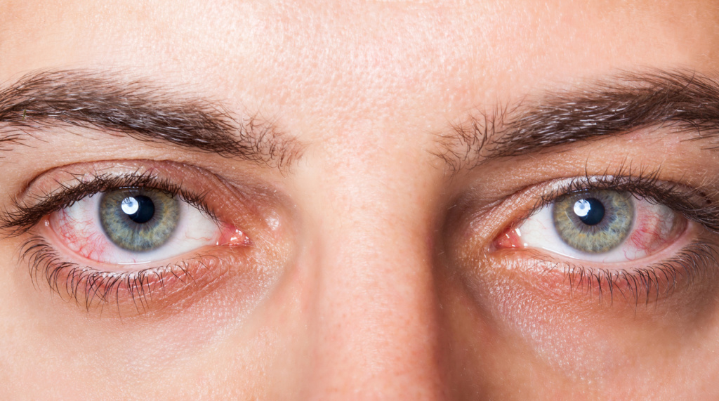 Офтальмолог объяснил, к чему может привести перенапряжение глаз и их частое покраснение