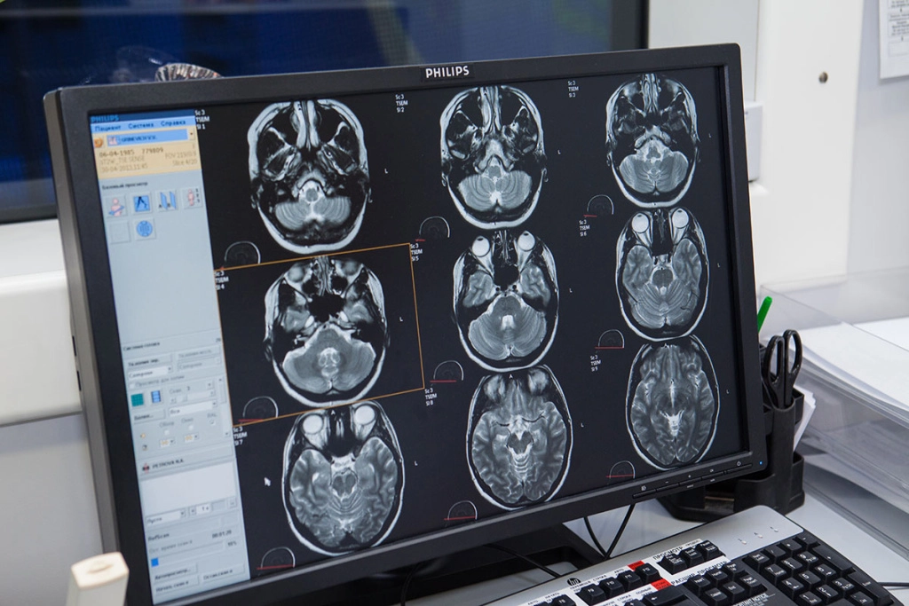 Сколько длится МРТ головного мозга