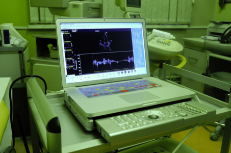  УЗИ молочных желез