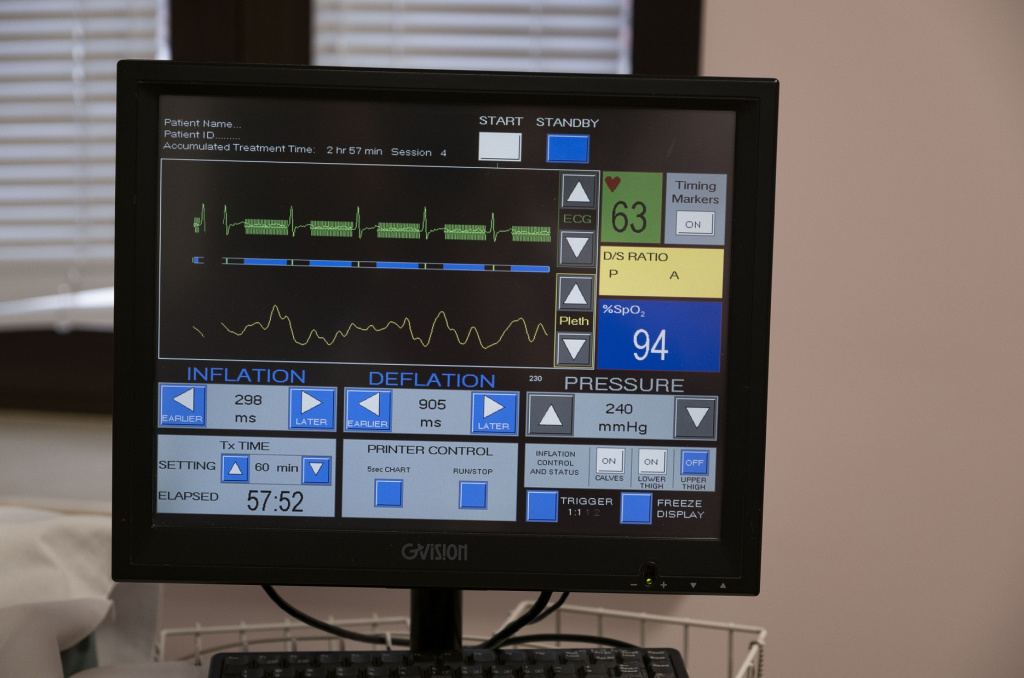 Усиленная наружная контрпульсация (УНКП) 1