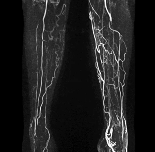КТ ангиография сосудов в Москве | Цены на компьютерную томографию ...