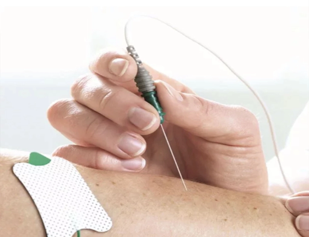 Электронейромиография-–-способ-увидеть-невидимое…-3