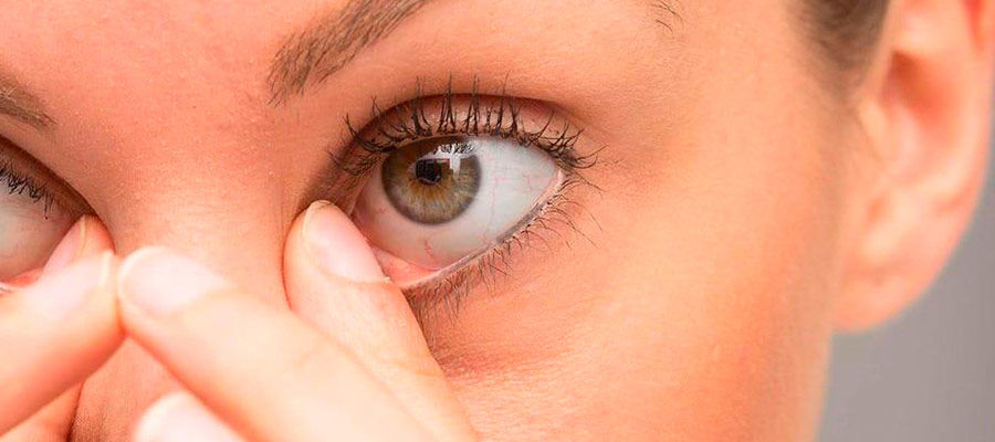 Почему так часто возникает ячмень на глазу: причины и способы лечения