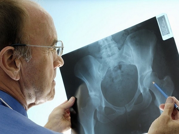 Причины и факторы риска рака костей