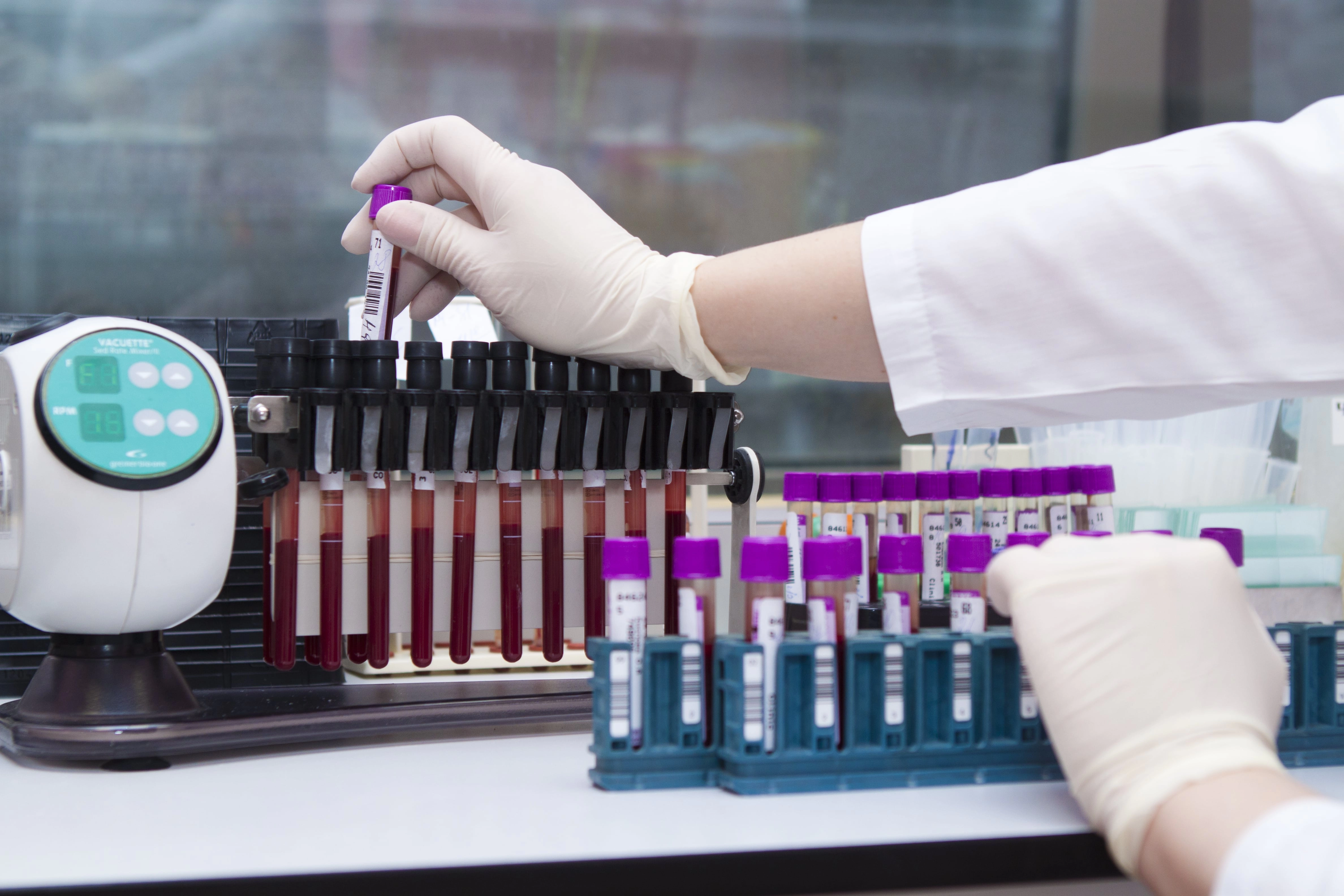 Программа обследования «Онкопоиск» для мужчин