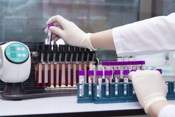 Программа обследования «Онкопоиск» для мужчин