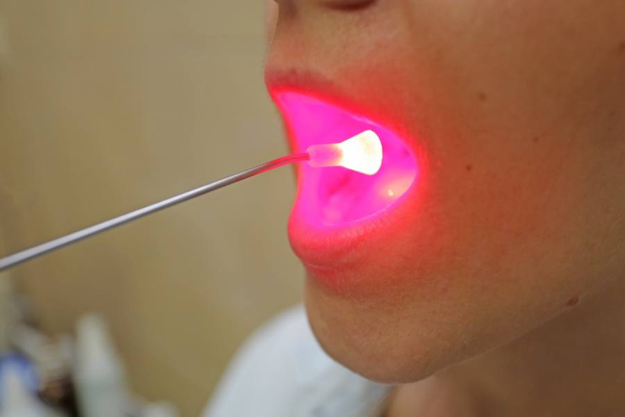 Лечение рака губы